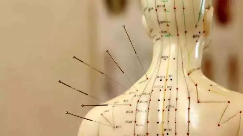 中醫(yī)針灸師怎么獲得？報考流程